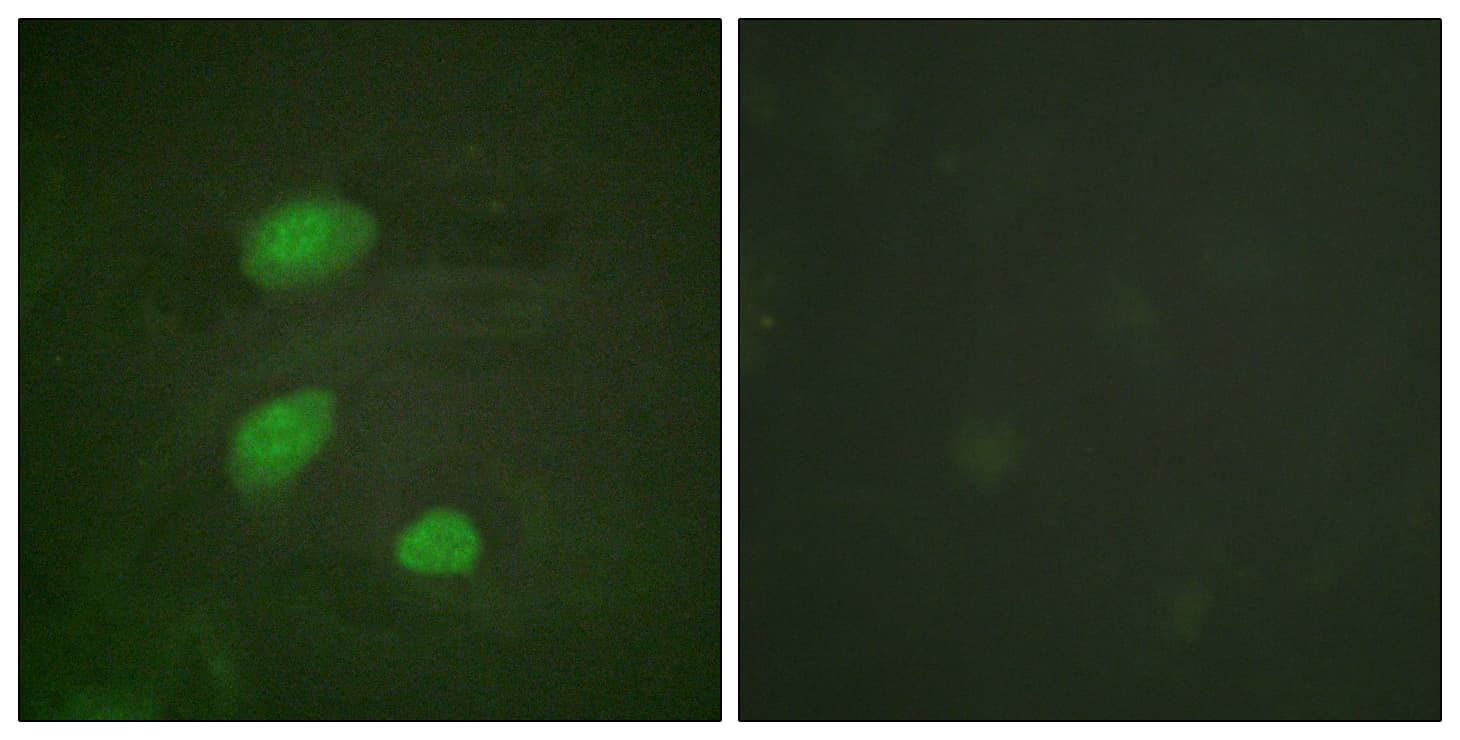 HIRA Antibody (phospho-Thr555)