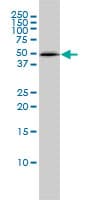 Monoclonal Mouse anti-Human PSMC4 Antibody (clone 3G8, IF, WB)
