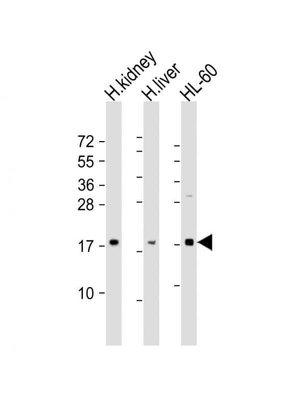 Polyclonal Rabbit anti-Human FHIT Antibody (aa19-54, WB)