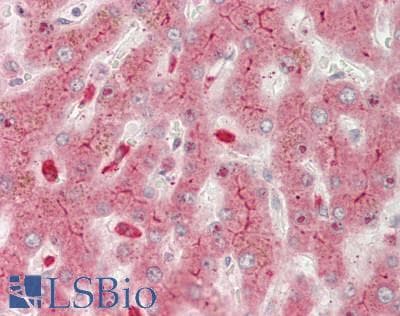 IHC-plus™ ABCC2 / MRP2 Antibody (aa991-1040)