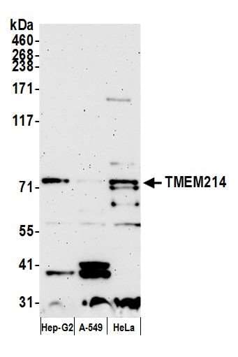 Polyclonal Rabbit anti-Human TMEM214 / FLJ20254 Antibody (aa1-50, WB)