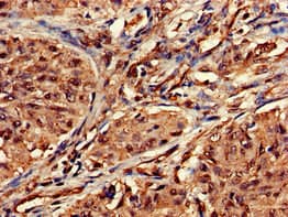 DOT1L / DOT1 Antibody
