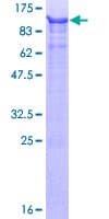 Human URI1 / NNX3 Protein (Recombinant GST)
