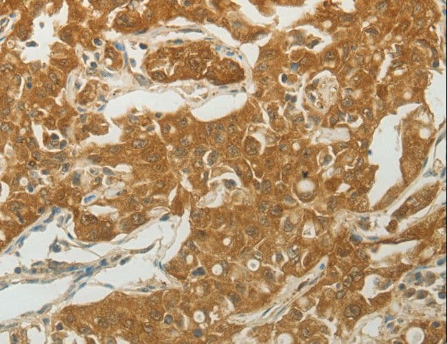 MC4R / Melanocortin 4 Receptor Antibody