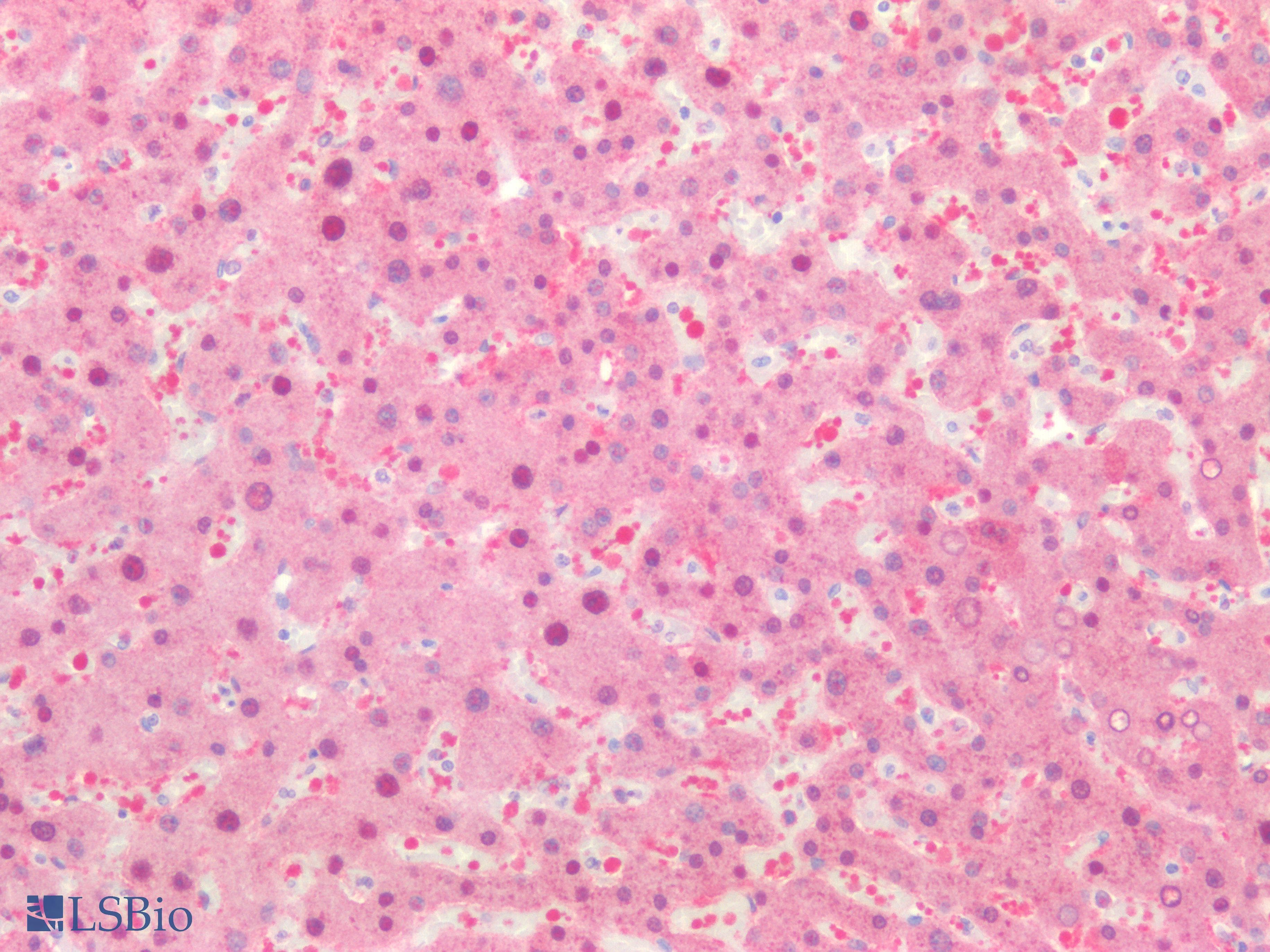 PathPlus™ ARG1 / Arginase 1 Antibody