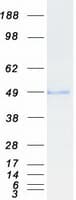 Human ARA55 / HIC-5 Protein (Recombinant Myc-DDK (Flag))