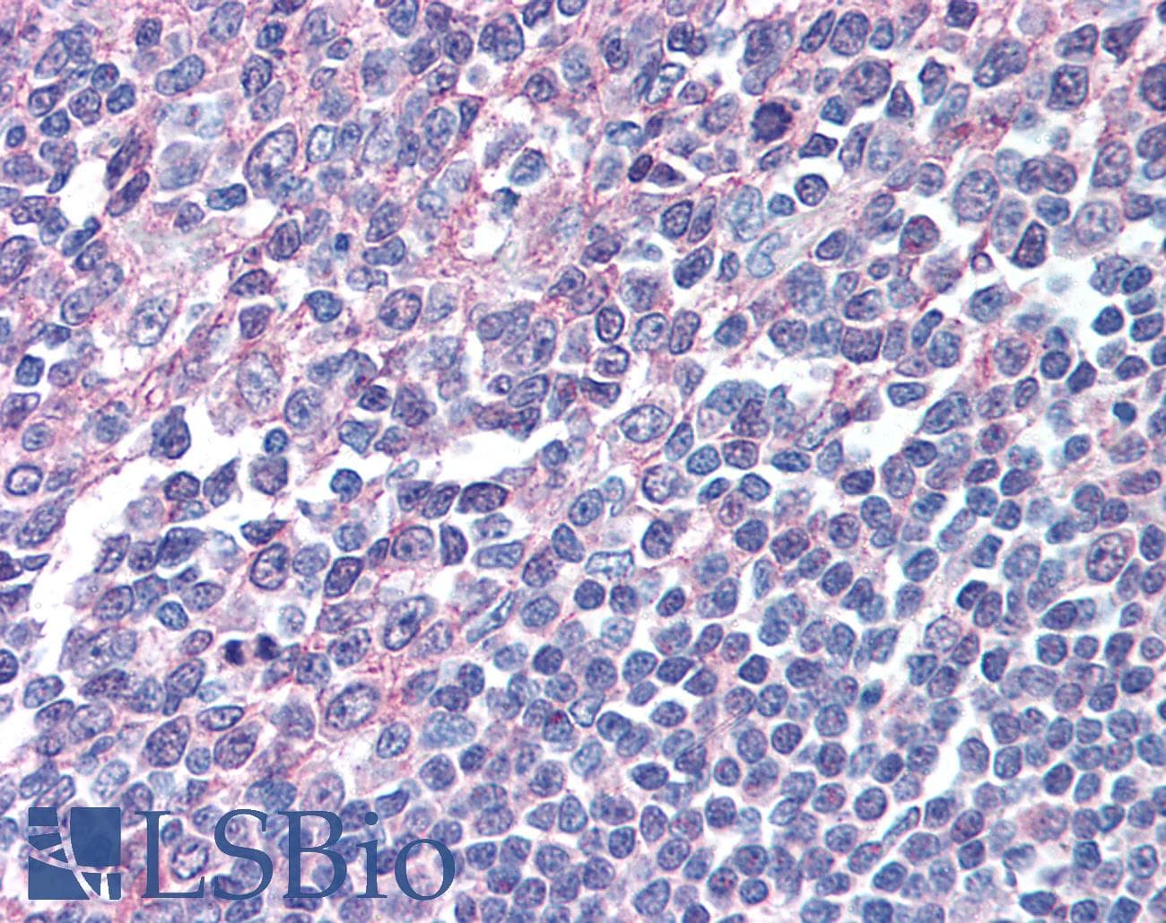 IHC-plus™ ICSBP / IRF8 Antibody (aa414-426)