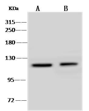 Polyclonal Rabbit anti-Human PTPRN / IA-2 Antibody (IHC, WB)