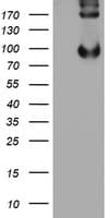 Monoclonal Mouse anti-Human P3H1 / LEPRE1 Antibody (clone OTI1A1, IHC, WB)