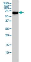 CDKN2AIP Antibody (clone 1A6)