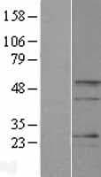 BARHL2 Protein (Over-Expression Lysate Myc-DDK (Flag))