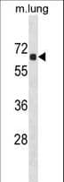 ACOT9 Antibody (aa213-240)