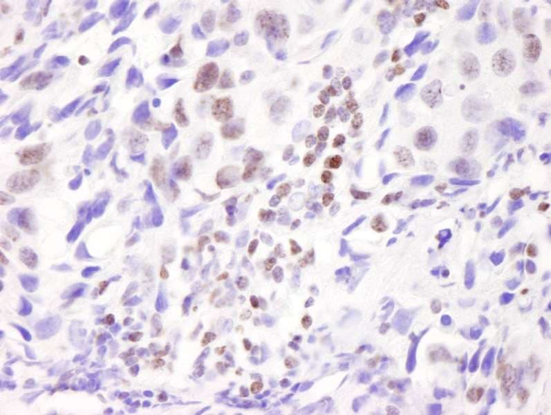 NCOA6 / ASC-2 Antibody (aa2000-C-term)