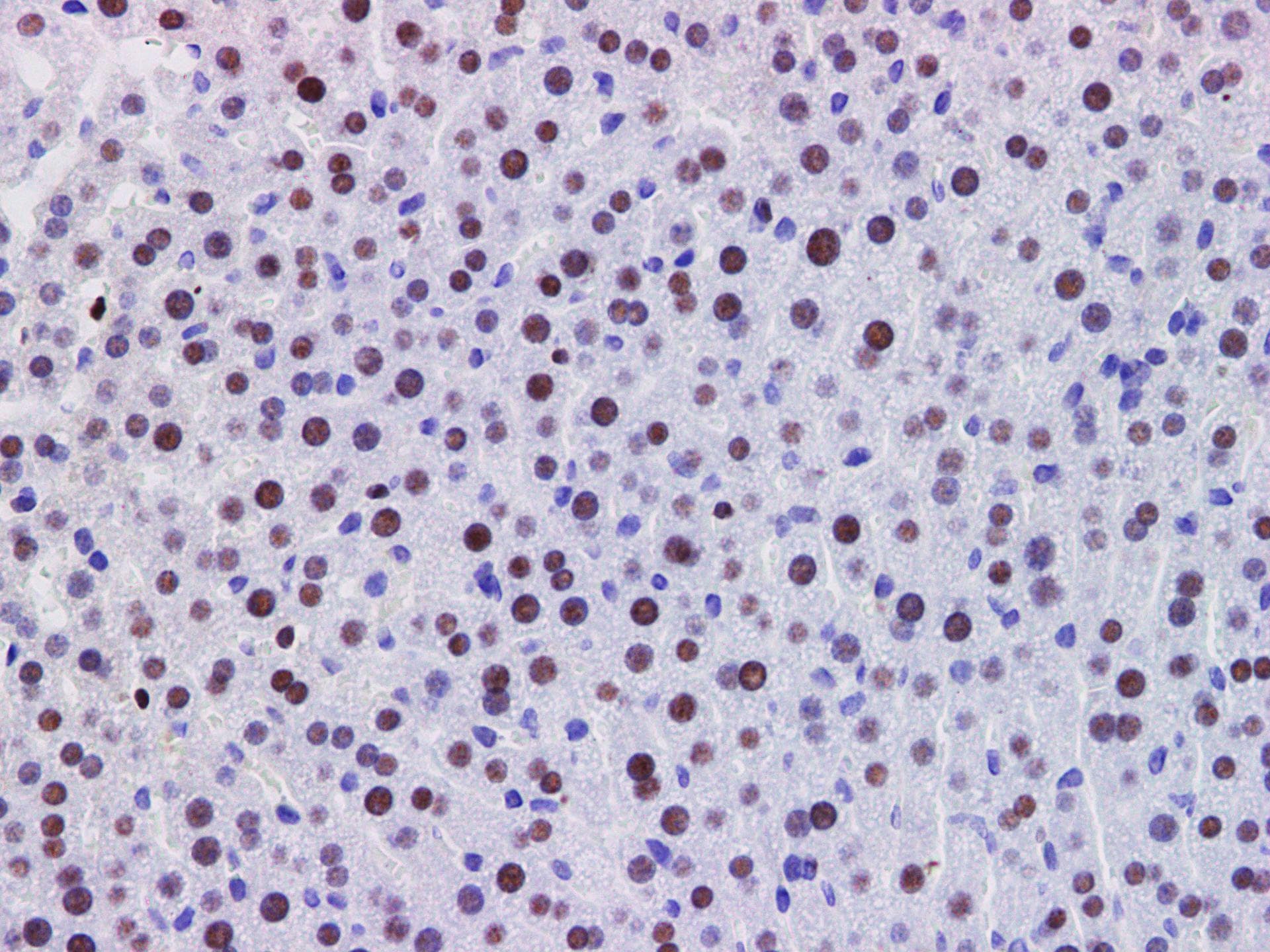 Polyclonal Rabbit anti-Human PDCD4 Antibody (IHC, WB)