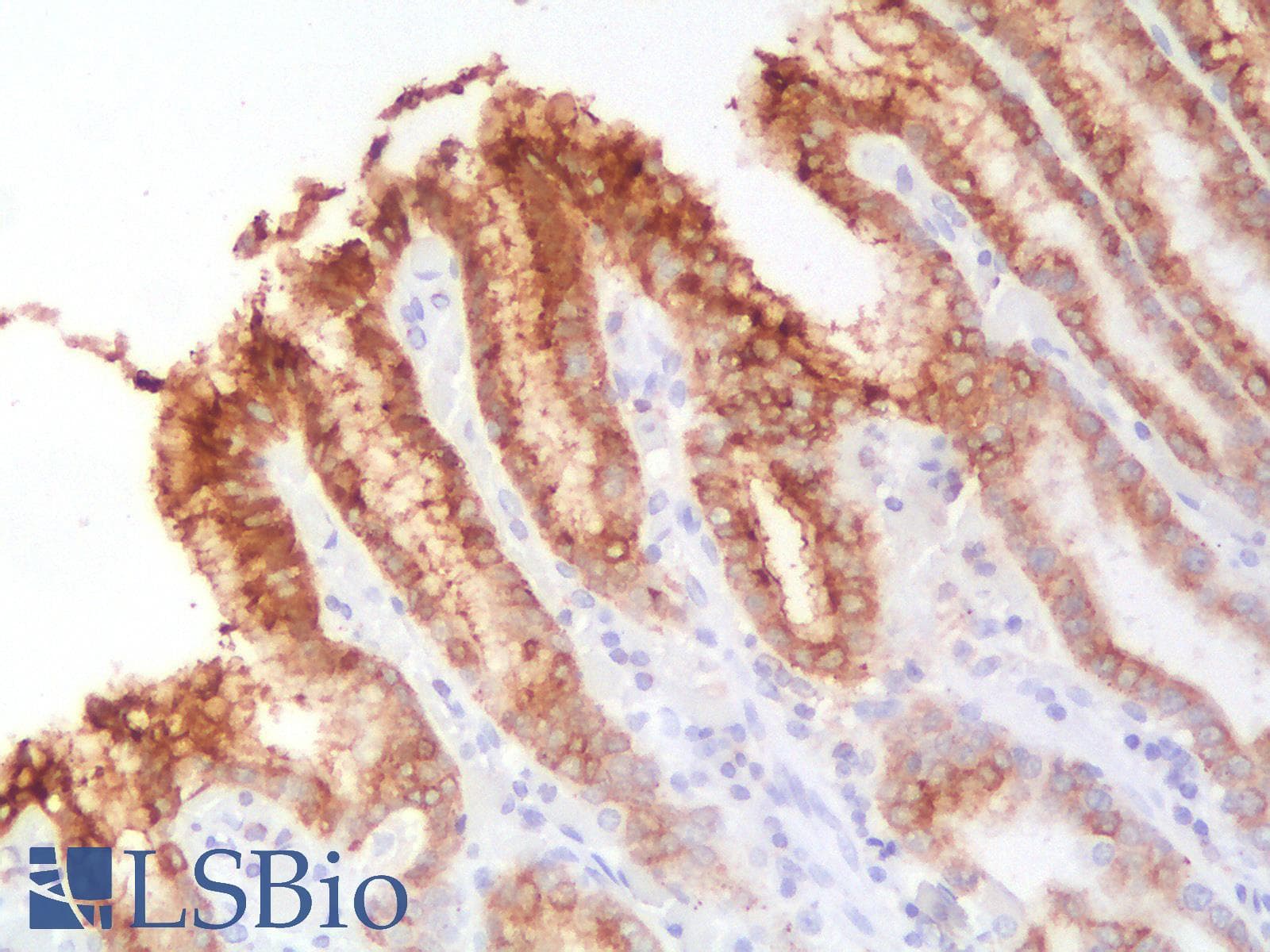 PathPlus™ Recombinant Monoclonal Rabbit anti-Human TFF1 / pS2 Antibody (clone TFF1/2969R, aa50-100, IHC)
