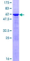Human SULT1E1 / Sulfotransferase 1E1 Protein (Recombinant GST)