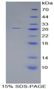 Human NPHS1 / Nephrin Protein (Recombinant His, N-Terminal)