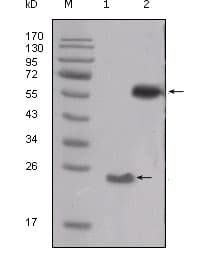 Monoclonal Mouse anti-Human SRC Antibody (clone 5D10C4, WB)