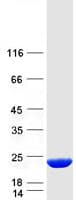 Human MRFAP1L1 Protein (Recombinant Myc-DDK (Flag))