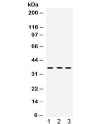 Polyclonal Rabbit anti-Human PRKAB1 / AMPK Beta 1 Antibody (WB)