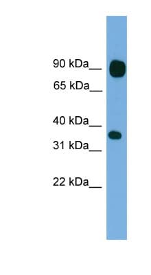 PCDHB15 Antibody (aa35-84)