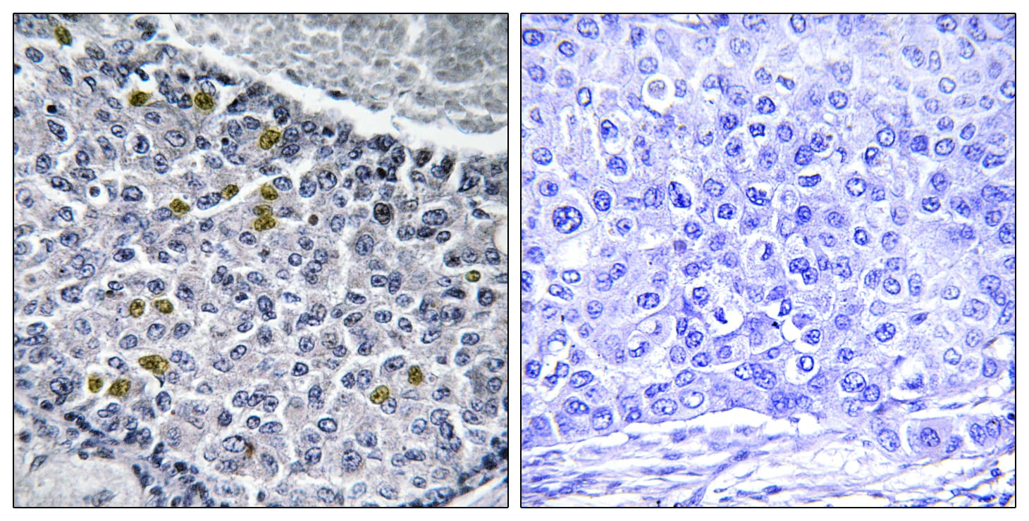 MAD1L1 / MAD1 Antibody (phospho-Ser428)