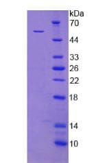 Human XRCC5 / Ku80 Protein (Recombinant His)
