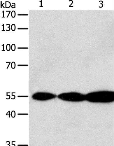 GSR / Glutathione Reductase Antibody