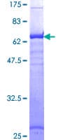 Human HLA-A Protein (Recombinant GST)