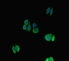 Polyclonal Rabbit anti-Human NFATC1 / NFAT2 Antibody (IHC, IF)