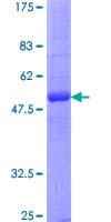 Human AQP2 / Aquaporin 2 Protein (Recombinant GST)