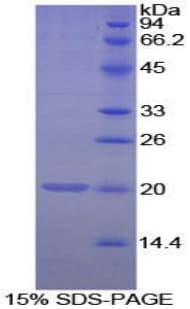 Mouse MGP / Matrix Gla-Protein (Recombinant His, N-Terminal)