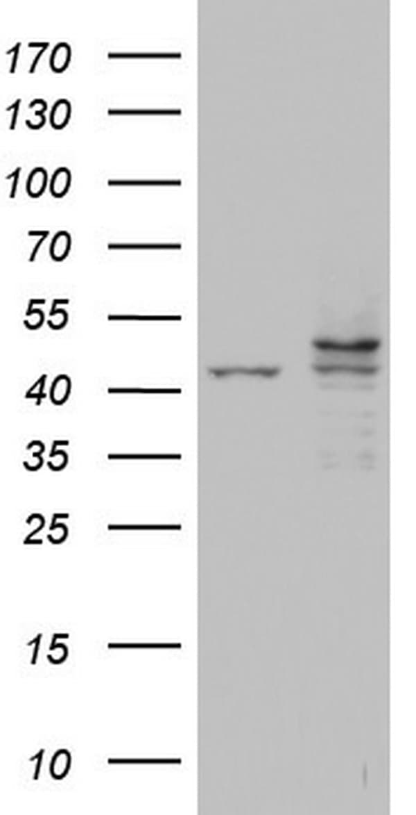 CSNK1E / CK1 Epsilon Antibody (aa153-416, clone OTI5C9)