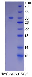 Human ERBB3 / HER3 Protein (Recombinant His-T7)