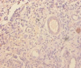 Polyclonal Rabbit anti-Human CCL4 / MIP-1 Beta Antibody (WB)