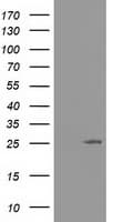 AK3 / Adenylate Kinase 3 Antibody (clone OTI6D6)