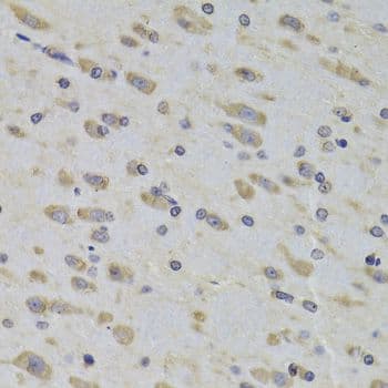 Polyclonal Rabbit anti-Human RPL3 / Ribosomal Protein L3 Antibody (IHC, WB)
