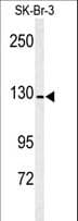 Polyclonal Rabbit anti-Human ANPEP / CD13 Antibody (aa615-641, WB)