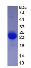 Rat VEGFA / VEGF Protein (Recombinant His, N-Terminal)