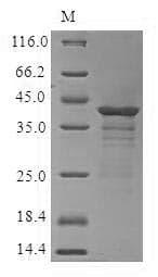 Human CCR6 Protein (Recombinant 6His, N-terminus)