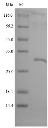 Macaque Growth Hormone Receptor / GHR Protein (Recombinant 6His, C-terminus)
