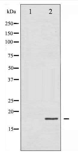 EIF4EBP1 / 4EBP1 Antibody (phospho-Thr45)