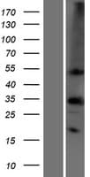 Human CA4 / Carbonic Anhydrase IV Protein (Over-Expression Lysate Myc-DDK (Flag))