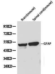Polyclonal Rabbit anti-Human GFAP Antibody (IHC, WB)