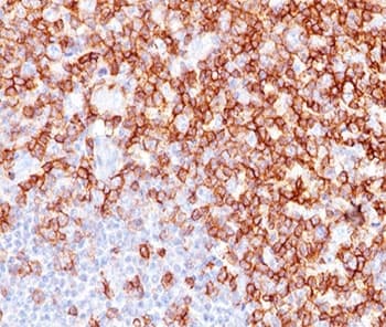 CD45RO Antibody (clone UCHL-1, Ready-to-Use)