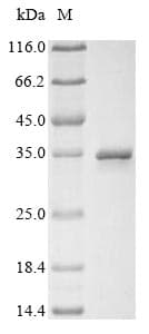 Rotavirus A Outer Capsid Protein VP4 (Recombinant 10His, N-terminus + Myc, C-terminus)
