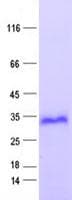 Human FHL2 Protein (Recombinant His, N-Terminal)