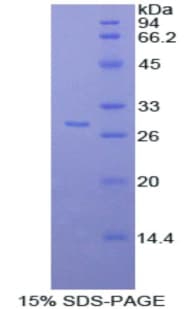 Rat CD163 Protein (Recombinant His)
