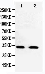Polyclonal Rabbit anti-Human CDK5 Antibody (aa273-292, WB)