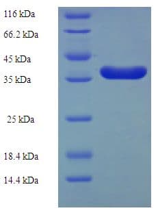 Human CBFB Protein (Recombinant His-SUMO)